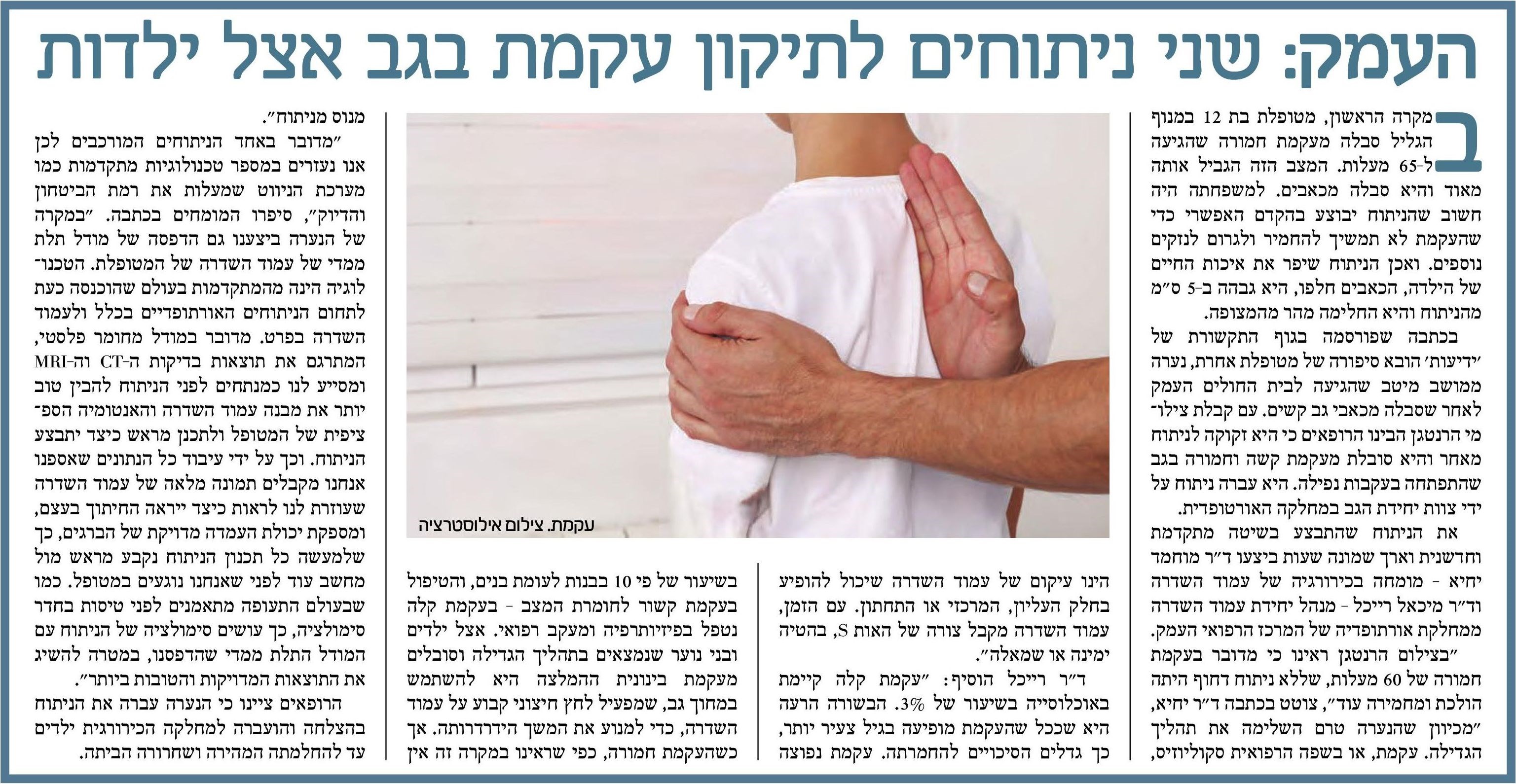 כתבה שני ניתוחים תיקון עקמת.jpg