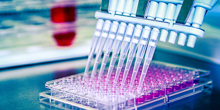 /rabin/he/departments-and-clinics/nashimbeilinson/pregnancy_and_childbirth/Pages/%D7%94%D7%99%D7%A8%D7%99%D7%95%D7%9F/genetic_di